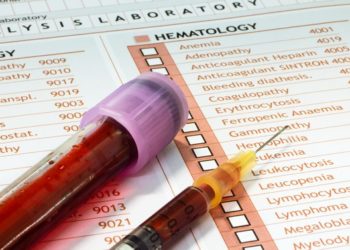 Как сдать анализ на гормоны: полезные советы по подготовке к нему