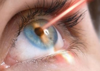 Особенности проведения лазерной коррекции зрения: что нужно знать