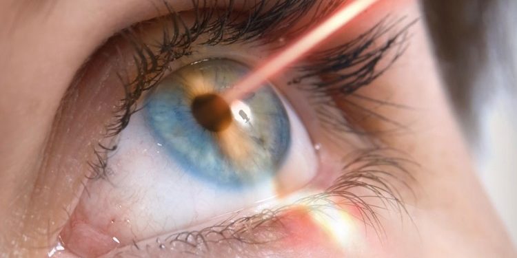 Особенности проведения лазерной коррекции зрения: что нужно знать