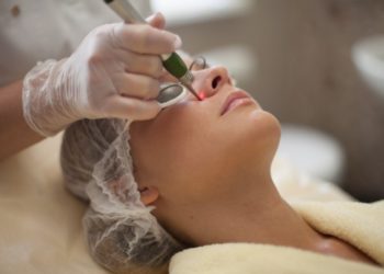 Особенности лазерного удаления сосудов: каких правил придерживаться