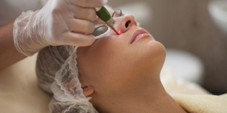 Особенности лазерного удаления сосудов: каких правил придерживаться