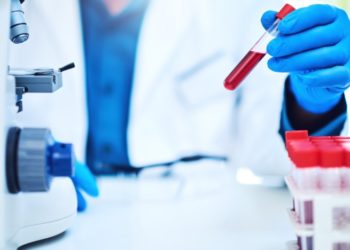 Що таке лужна фосфатаза: основні відомості про цей фермент