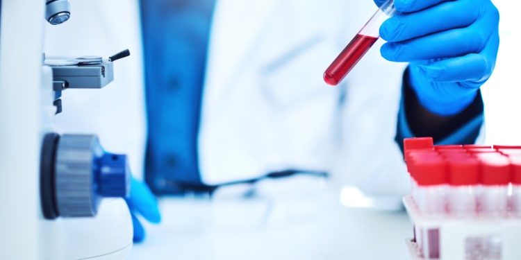 Що таке лужна фосфатаза: основні відомості про цей фермент