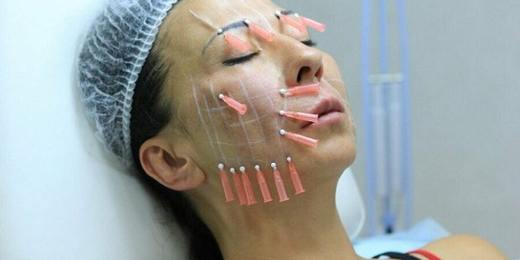 Основні відомості про особливості використання колагенових ниток