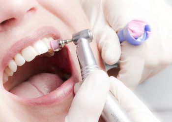 Почему важно регулярно чистить зубы в стоматологии: особенности услуги