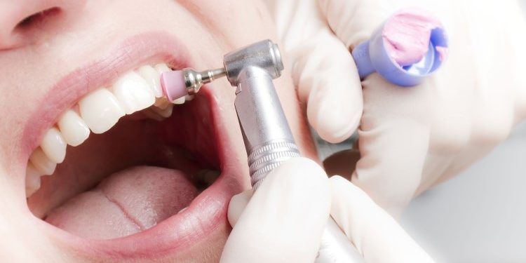 Почему важно регулярно чистить зубы в стоматологии: особенности услуги