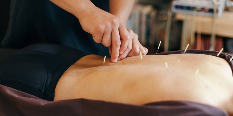 Главные преимущества и особенности иглотерапии: в каких случаях она показана