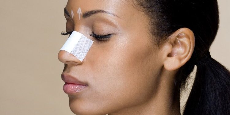 Особливості ринопластики: що треба знати про правила її виконання