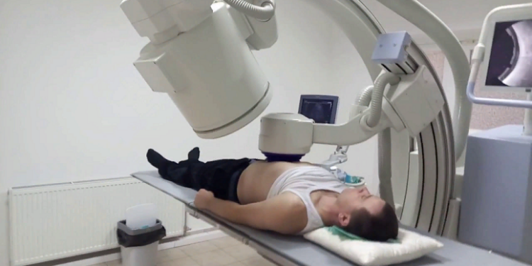 Особенности лазерного дробления камней в почках и советы