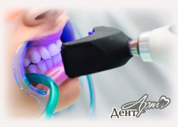 Какие средства рекомендуется использовать для отбеливания зубов