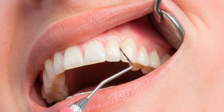 Основные сведения об особенностях пародонтологии: что она в себя включает