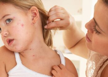 Как вылечить чесотку у ребенка: полезные советы по выбору препаратов