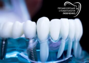 Які ціни на імплантацію зубів у 2024 році в Харкові?