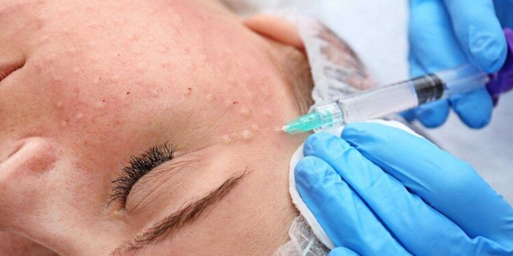 Когда показана биоревитализация и как она проводится: основные правила