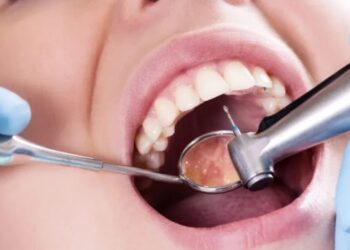 Почему на зубах появляется кариес и как правильно его лечить