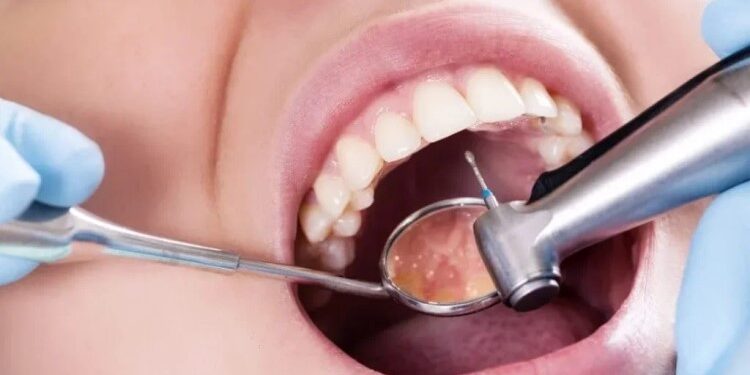 Почему на зубах появляется кариес и как правильно его лечить