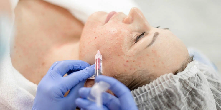 Преимущества биоревитализации лица гиалуроновой кислотой