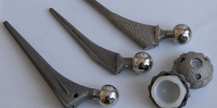 Эндопротез: понятие, требования, рекомендации и советы