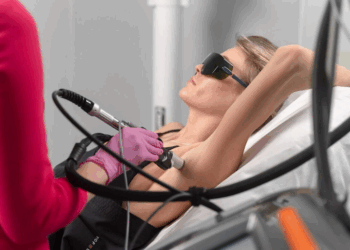 Лазерное удаление волос: достоинства, правила и рекомендации