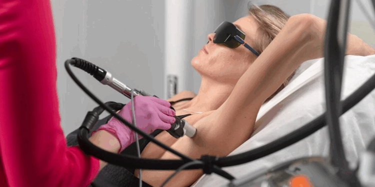 Лазерное удаление волос: достоинства, правила и рекомендации