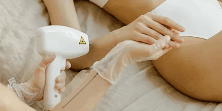 Как проводится лазерная эпиляция: правила и советы