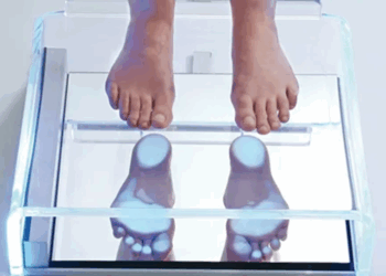 Диагностика плоскостопия: что нужно знать и рекомендации