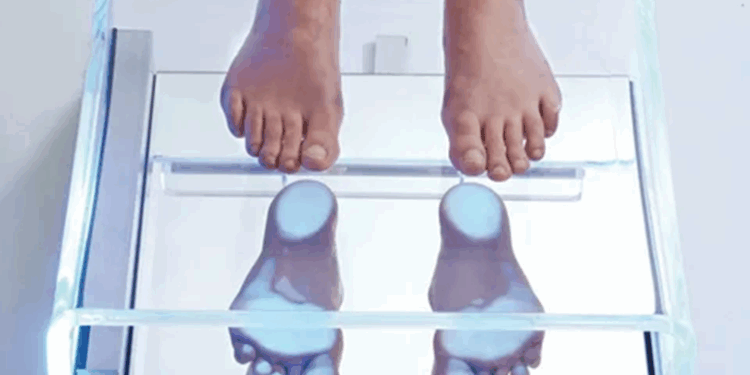 Диагностика плоскостопия: что нужно знать и рекомендации