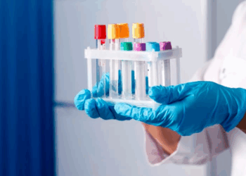 Все преимущества и особенности проведения анализов на дому для удобства и быстроты результатов