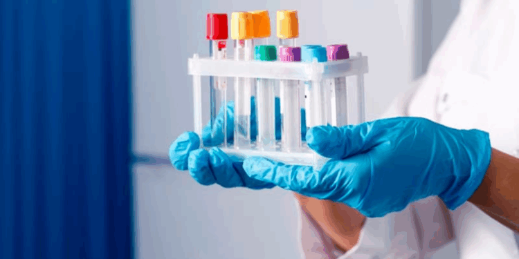 Все преимущества и особенности проведения анализов на дому для удобства и быстроты результатов