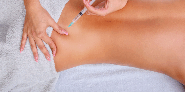 Преимущества инъекционного липолиза перед традиционными методами липосакции